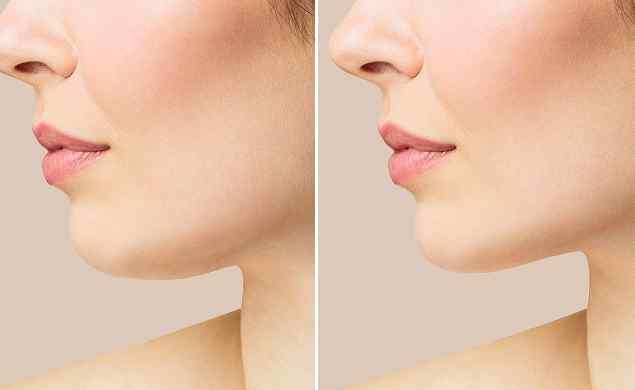 https://www.walkerchiropratique.com/wp-content/uploads/2026/05/image_before_after_02.jpg